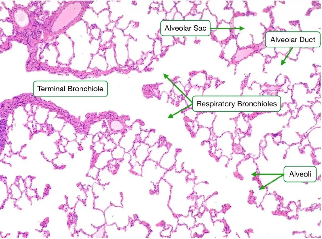 Lung field labelled: terminal bronchiole, respiratory bronchioles, alveolar duct, alveolar sac, alveoli