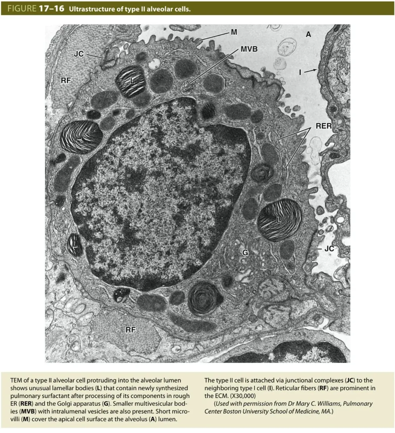 Junqueira fig 17-16: TEM of a type II cell with lamellar bodies, RER, Golgi, MVB, microvilli