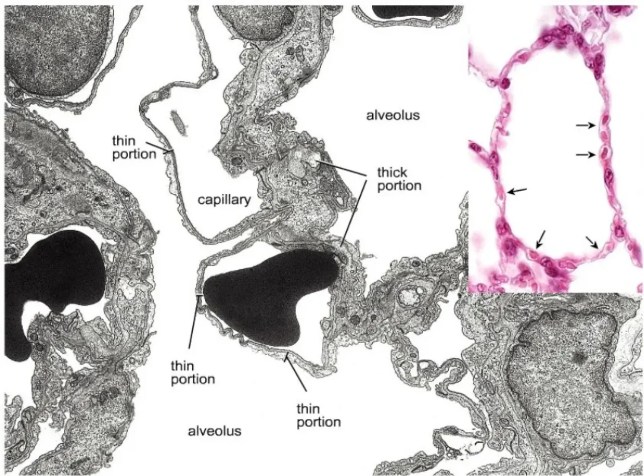 EM: thin portion (barrier) vs thick portion (interstitium) of the alveolar septum