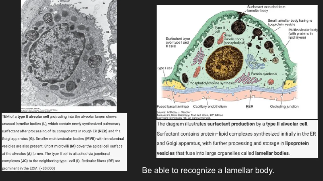 TA slide: TEM of a type II cell and diagram of surfactant made via RER, Golgi, MVB, lamellar bodies