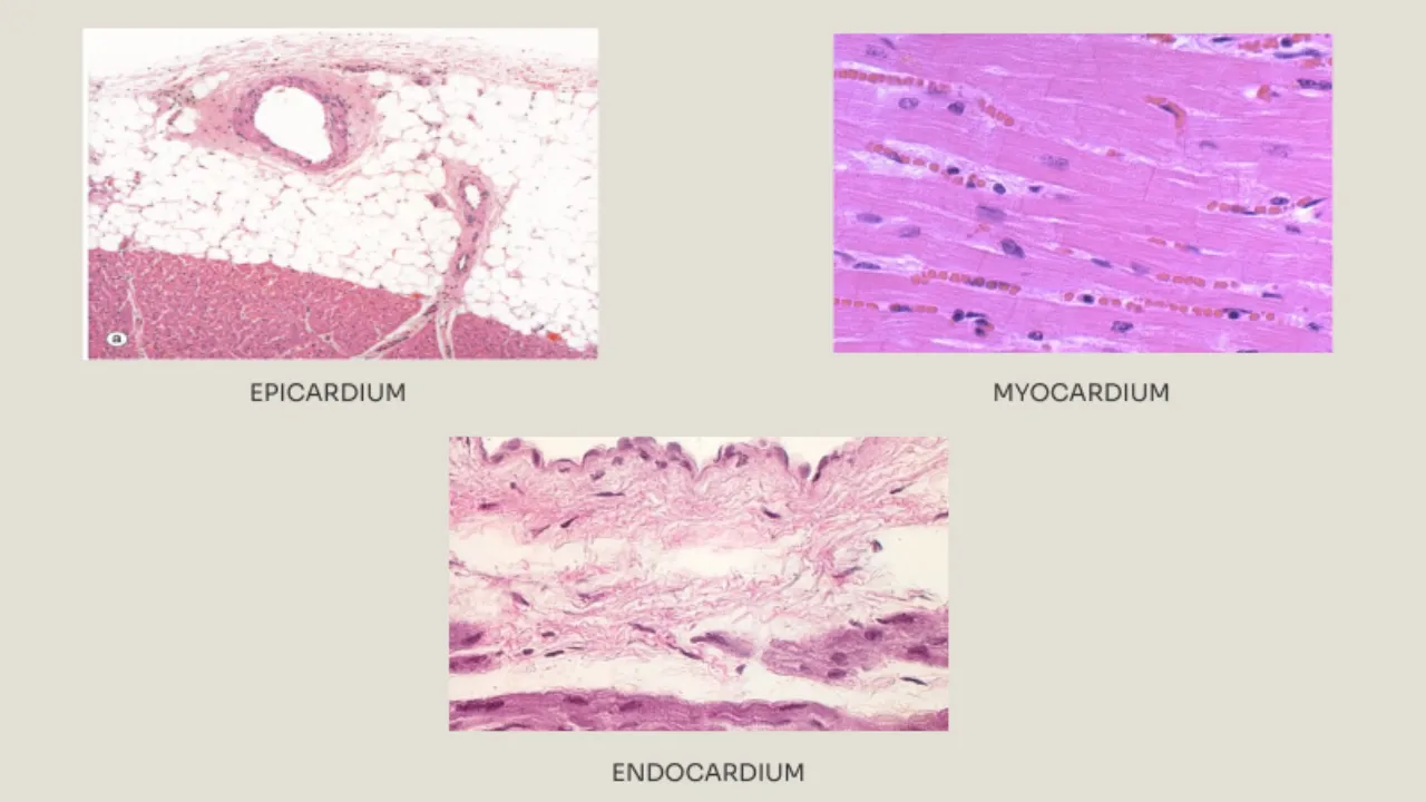 TA slide: labelled micrographs of epicardium (fat, vessel), myocardium and endocardium