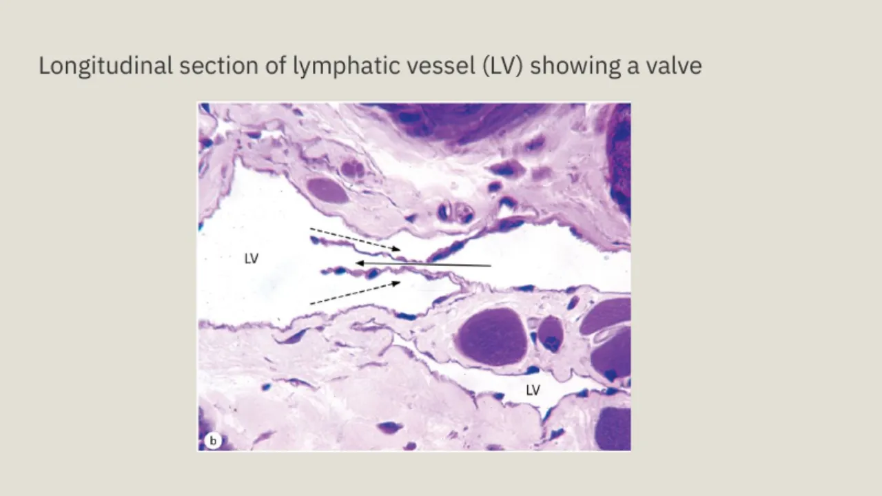 TA slide: longitudinal section of a lymphatic vessel (LV) showing a valve