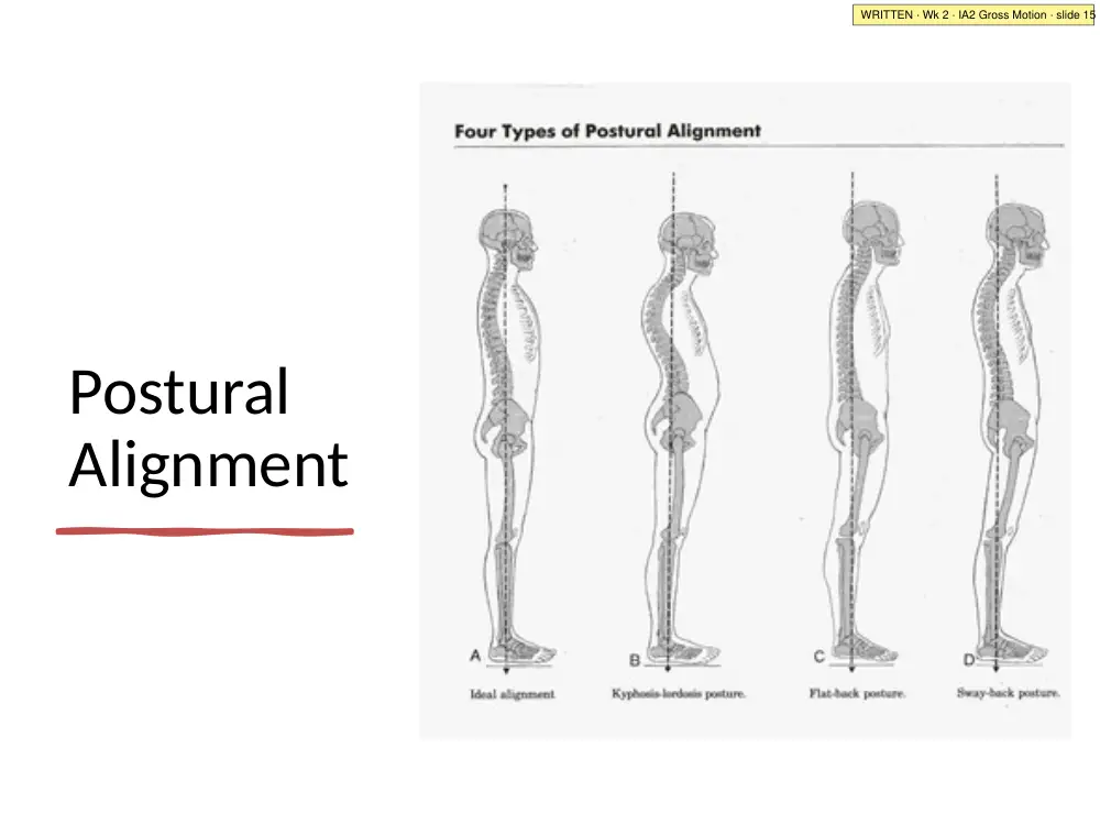 IA2 slide 15: four types of postural alignment (A ideal, B kyphosis-lordosis, C flat back, D sway back)