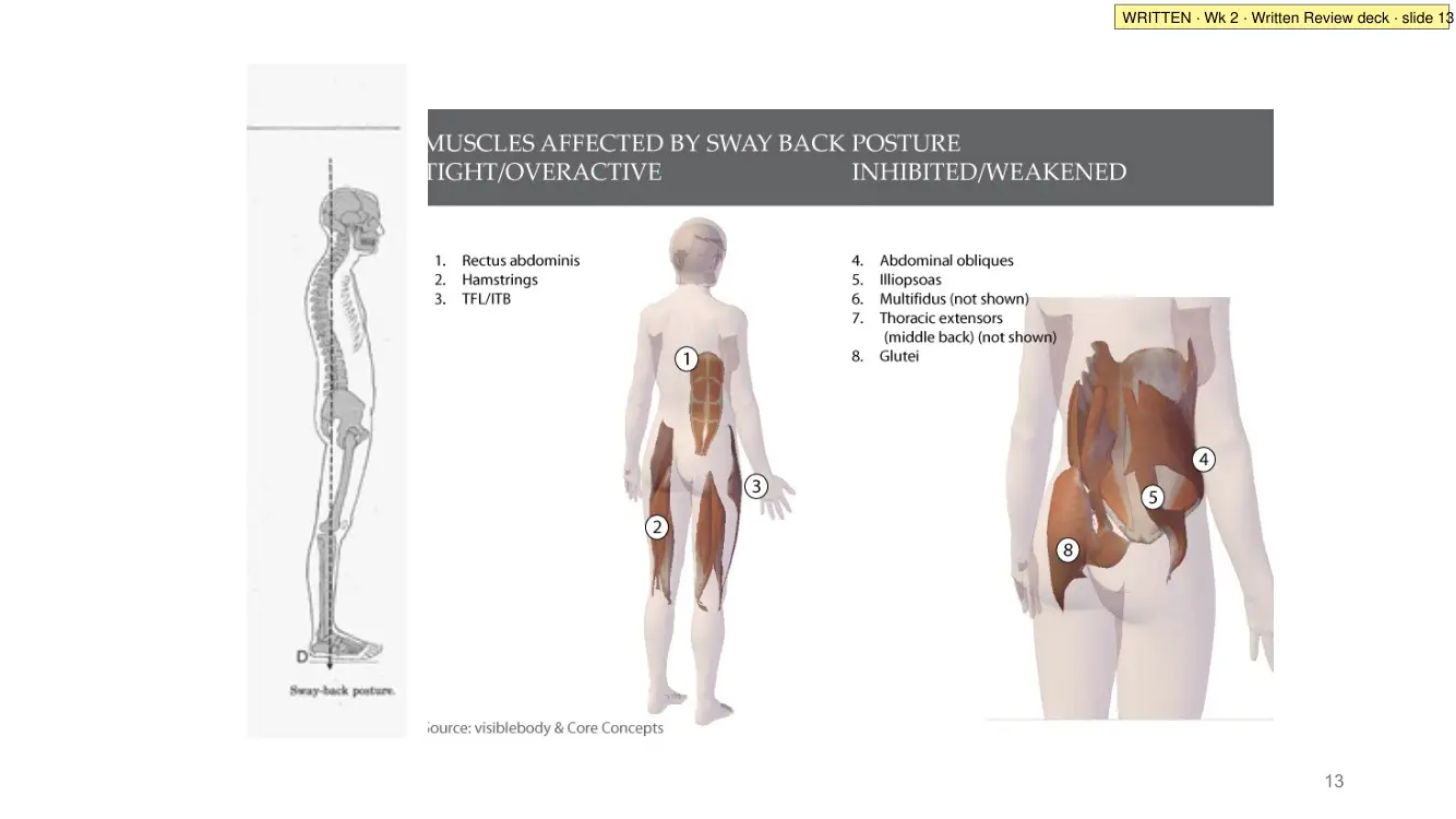 Written Review slide 13: sway back muscles