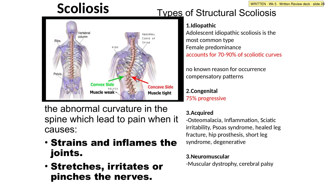Written Review slide 28: types of structural scoliosis