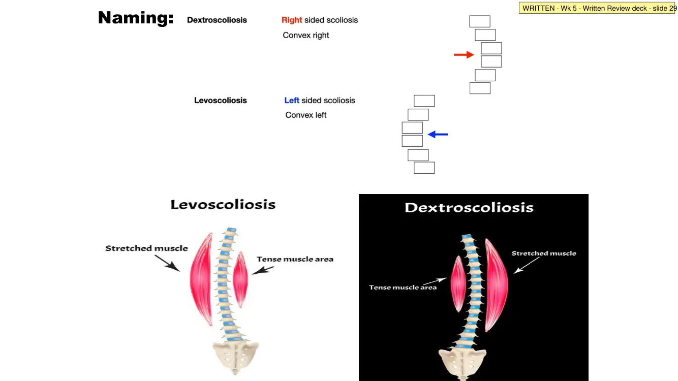 Written Review slide 29: naming scoliosis