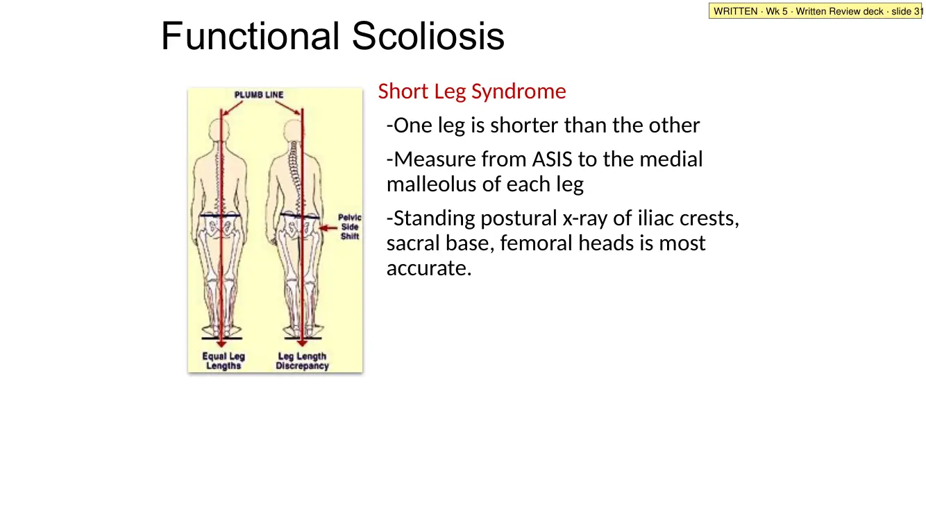 Written Review deck · slide 31