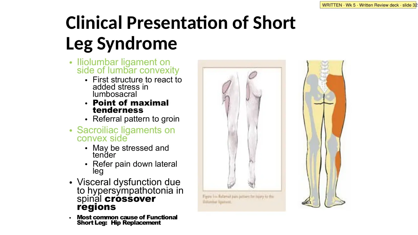 Written Review slide 32: clinical presentation of a short leg