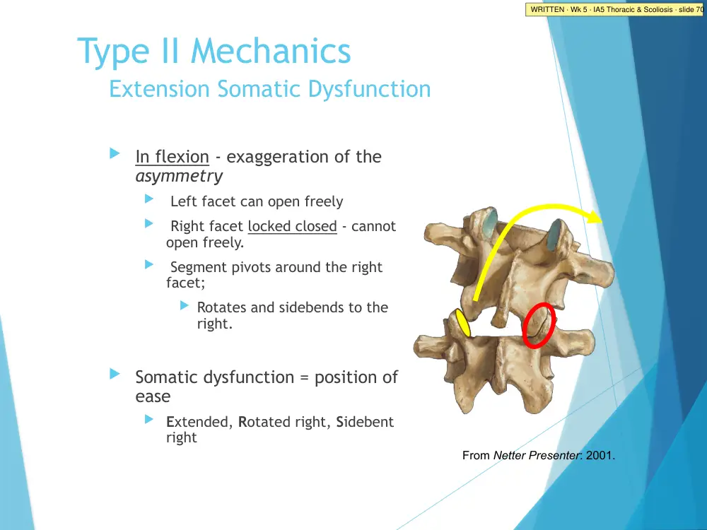 IA5 Thoracic & Scoliosis · slide 70
