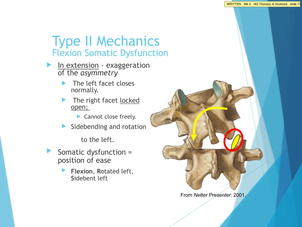 IA5 Thoracic & Scoliosis · slide 73