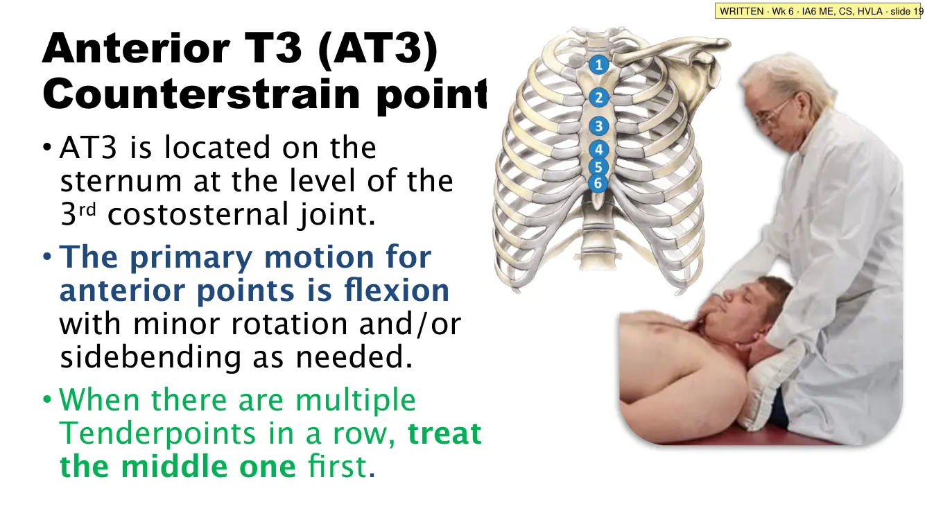 IA6 slide 19: the AT3 point; treat the middle point first