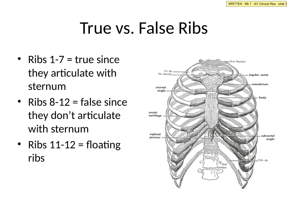 IA7 Clinical Ribs · slide 7