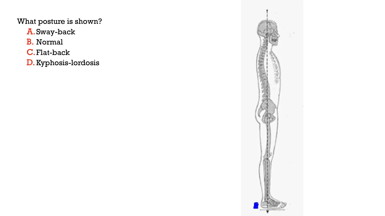 Figure for question 94