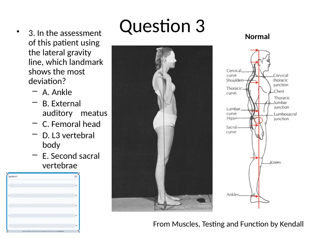 Figure for question 79
